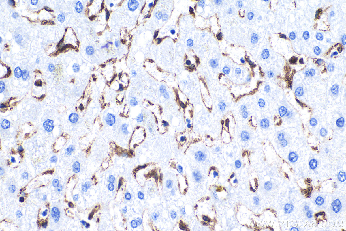 Immunohistochemical analysis of paraffin-embedded human liver tissue slide using 80165-1-RR (TMEM173/STING antibody) at dilution of 1:2000. Heat mediated antigen retrieval with Tris-EDTA buffer (pH 9.0). Multi-rAb™ Polymer HRP-Goat anti-rabbit Recombinant secondary antibody RGAR011 was used for detection.