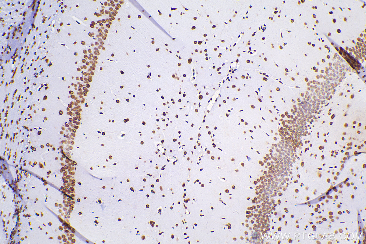 Immunohistochemical analysis of paraffin-embedded rat brain tissue slide using 80001-1-RR (TDP-43 antibody) at dilution of 1:4000 (under 10x lens). Heat mediated antigen retrieval with Tris-EDTA buffer (pH 9.0). Multi-rAb™ Polymer HRP-Goat anti-rabbit Recombinant secondary antibody RGAR011 was used for detection. The staining was performed on Celnovte's CNT360-M1 autostainer.