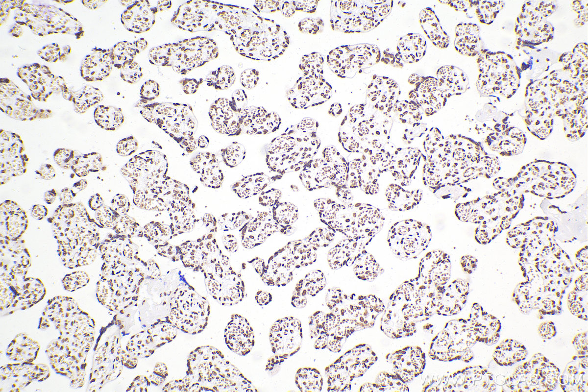 Immunohistochemical analysis of paraffin-embedded human placenta tissue slide using 80001-1-RR (TDP-43 antibody) at dilution of 1:4000 (under 10x lens). Heat mediated antigen retrieval with Tris-EDTA buffer (pH 9.0). Multi-rAb™ Polymer HRP-Goat anti-rabbit Recombinant secondary antibody RGAR011 was used for detection. The staining was performed on Celnovte's CNT360-M1 autostainer.