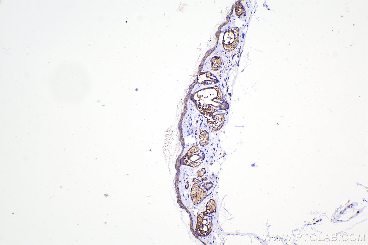 Immunohistochemical analysis of paraffin-embedded mouse skin tissue slide using 20874-1-AP (E-cadherin antibody) at dilution of 1:5000 (under 10x lens). Heat mediated antigen retrieval with Tris-EDTA buffer (pH 9.0). Multi-rAb Polymer HRP-Goat anti-rabbit Recombinant secondary antibody RGAR011 was used for detection. The staining was performed on Celnovte's CNT360-M1 autostainer.