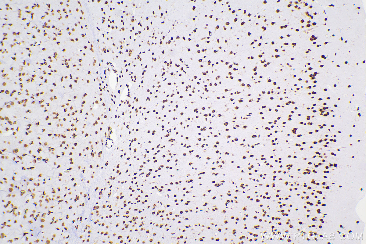 Immunohistochemical analysis of paraffin-embedded mouse brain tissue slide using 80001-1-RR (TDP-43 antibody) at dilution of 1:4000 (under 10x lens). Heat mediated antigen retrieval with Tris-EDTA buffer (pH 9.0). Multi-rAb™ Polymer HRP-Goat anti-rabbit Recombinant secondary antibody RGAR011 was used for detection. The staining was performed on Celnovte's CNT360-M1 autostainer.