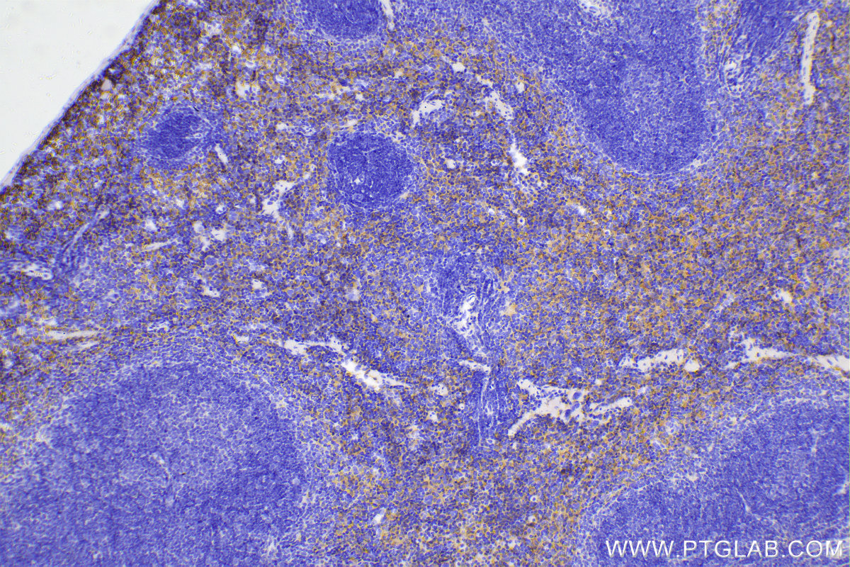 Immunohistochemical analysis of paraffin-embedded mouse spleen tissue slide using 81668-1-RR (F4/80 antibody) at dilution of 1:5000 (under 10x lens). Heat mediated antigen retrieval with Tris-EDTA buffer (pH 9.0). Multi-rAb™ Polymer HRP-Goat anti-rabbit Recombinant secondary antibody RGAR011 was used for detection. The staining was performed on Celnovte's CNT360-M1 autostainer.