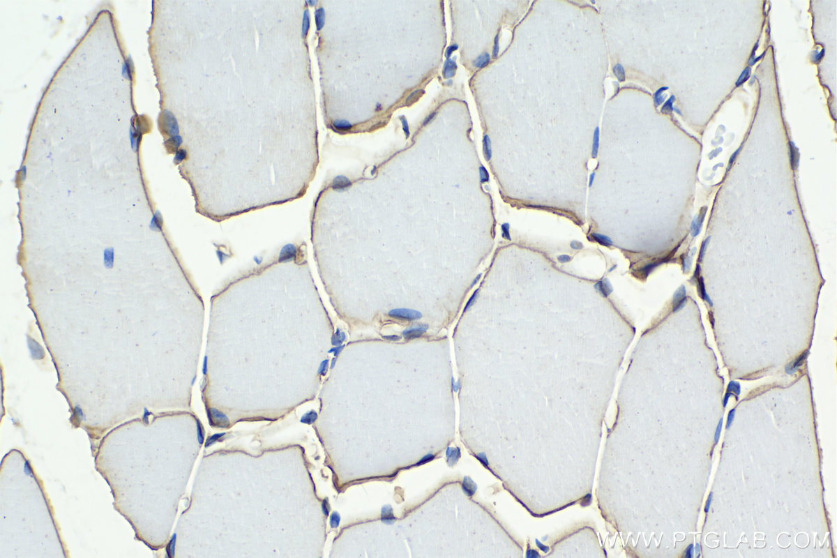 Immunohistochemical analysis of paraffin-embedded rat skeletal muscle tissue slide using 12715-1-AP (Dystrophin antibody) at dilution of 1:10000 (under 40x lens). Heat mediated antigen retrieval with Tris-EDTA buffer (pH 9.0). Multi-rAb™ Polymer HRP-Goat Anti-Rabbit/Mouse Universal Recombinant secondary antibody RGAU011 was used for detection.