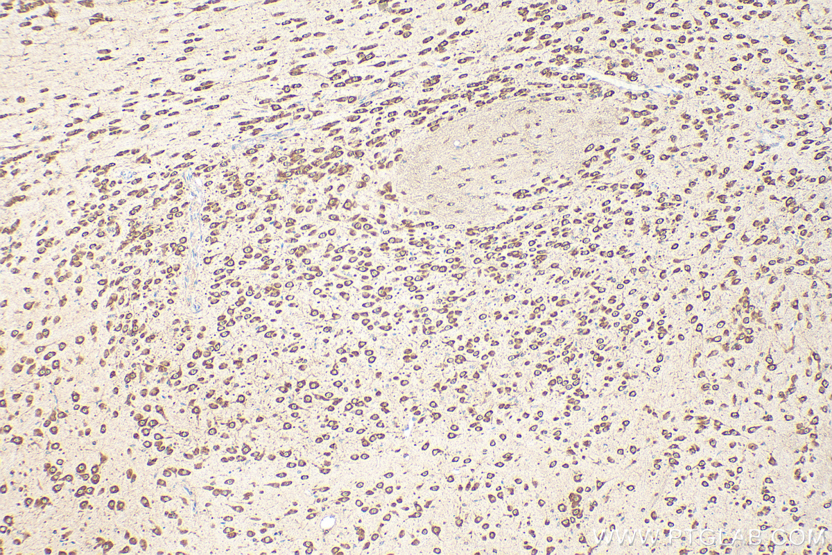 Immunohistochemical analysis of paraffin-embedded mouse brain tissue slide using 10095-2-AP (EEF1B2 antibody) and Biotin-conjugated Donkey Anti-Rabbit IgG(H+L) (SA00004-11) at dilution of 1:200.