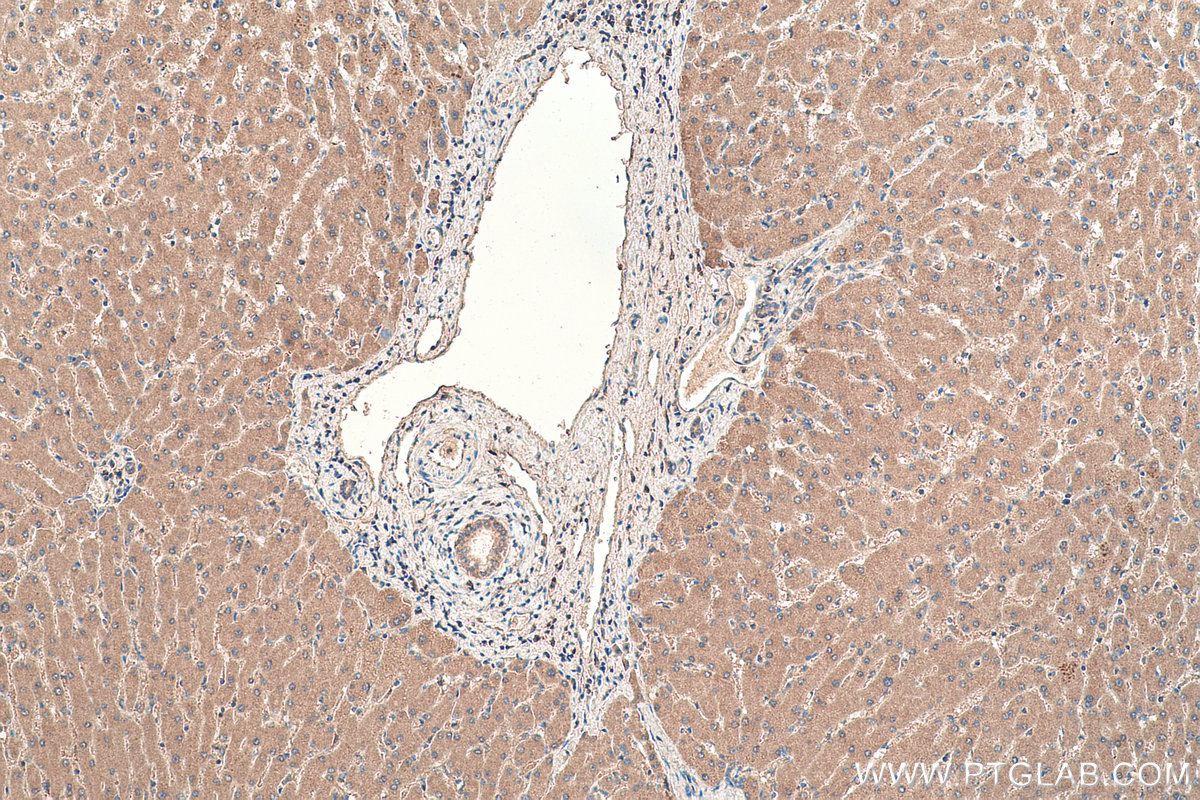 Immunohistochemical analysis of paraffin-embedded human liver tissue slide using KHC0391 (AADAC IHC Kit).