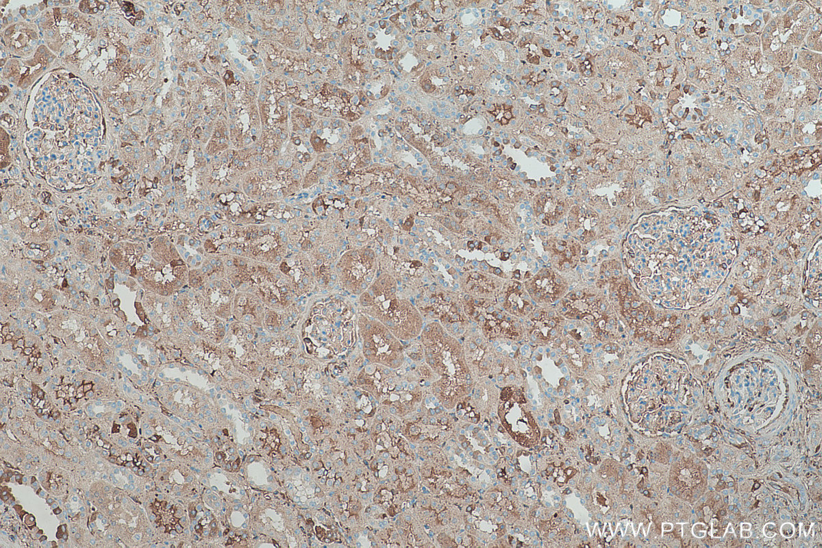 Immunohistochemical analysis of paraffin-embedded human kidney tissue slide using KHC0379 (SERPINA1/AAT IHC Kit).