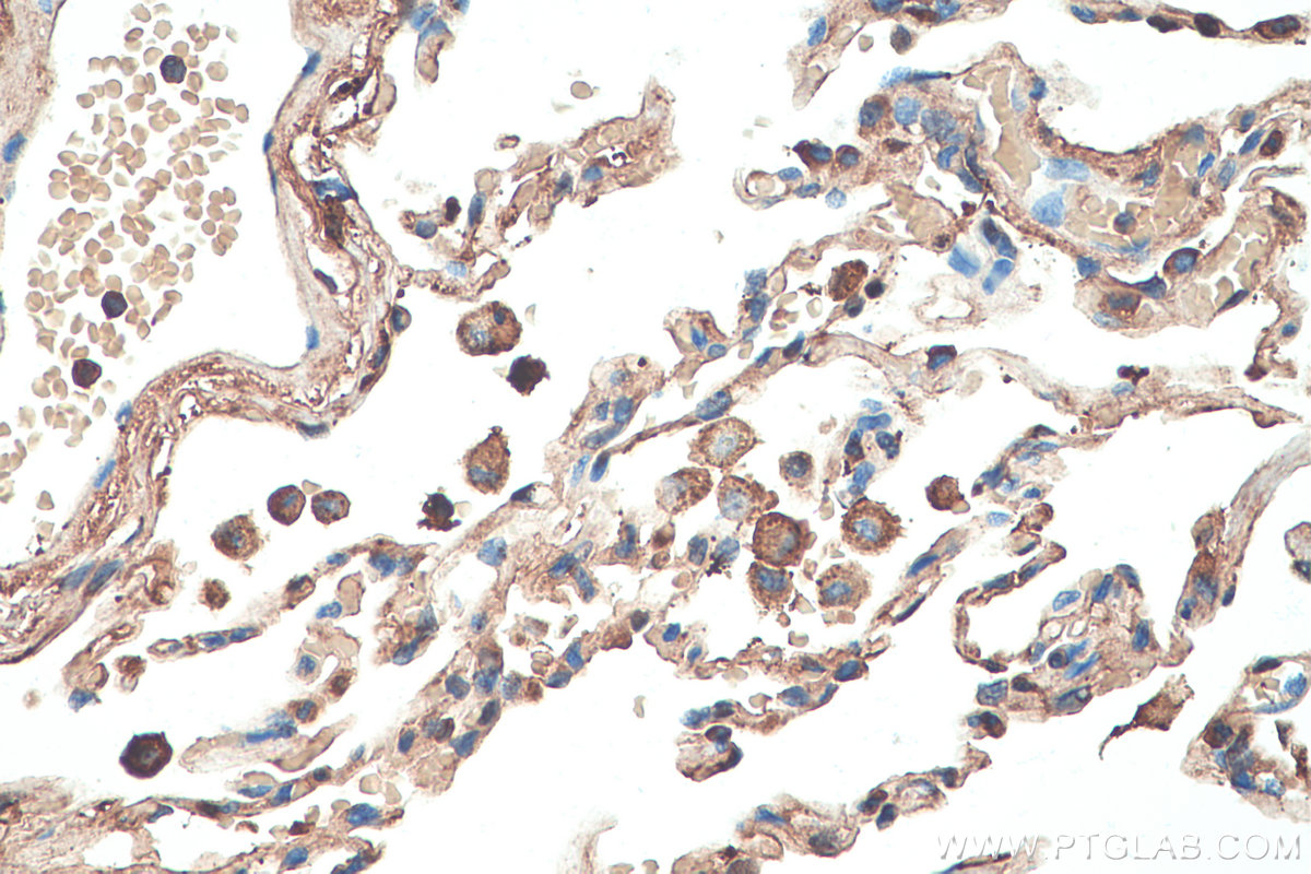 Immunohistochemical analysis of paraffin-embedded human lung tissue slide using KHC0379 (SERPINA1/AAT IHC Kit).