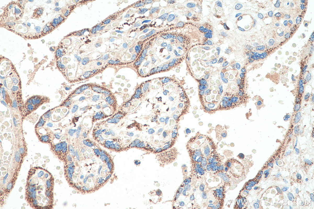 Immunohistochemical analysis of paraffin-embedded human placenta tissue slide using KHC0547 (ABAT IHC Kit).