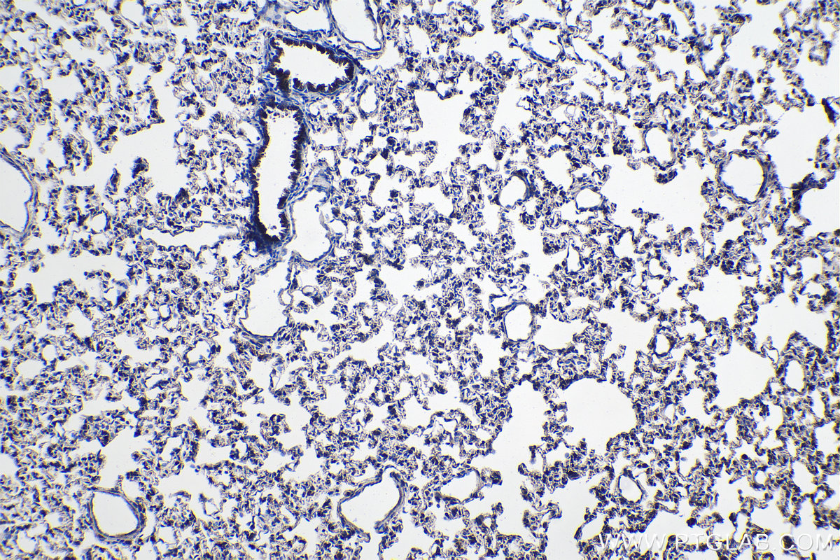 Immunohistochemical analysis of paraffin-embedded rat lung tissue slide using KHC1096 (ABCA3 IHC Kit).