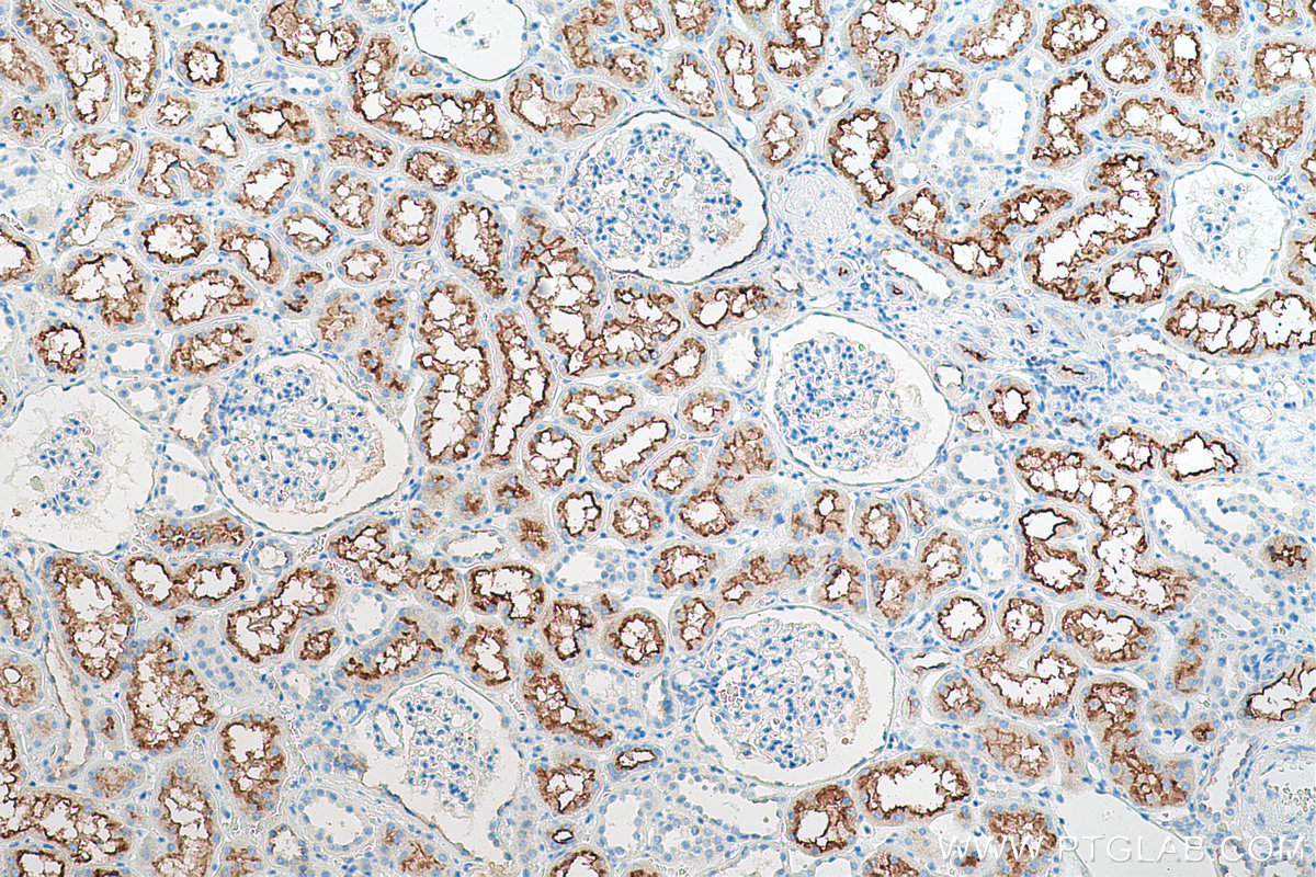 Immunohistochemical analysis of paraffin-embedded human kidney tissue slide using KHC0820 (P glycoprotein IHC Kit).