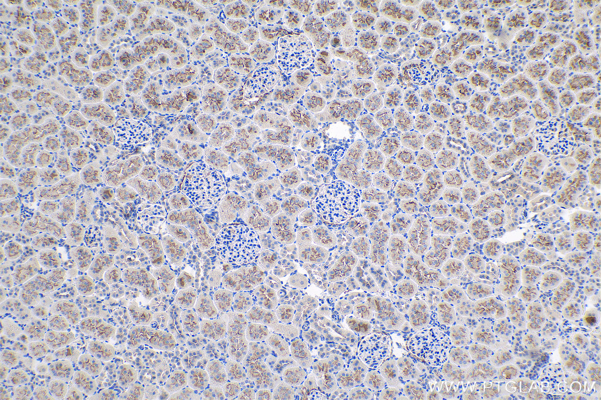 Immunohistochemical analysis of paraffin-embedded rat kidney tissue slide using KHC0820 (P glycoprotein IHC Kit).