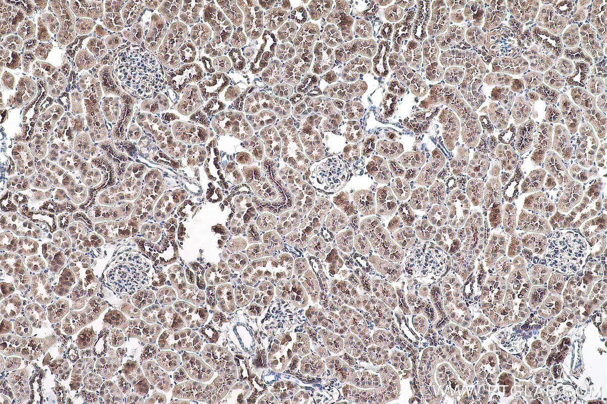 Immunohistochemical analysis of paraffin-embedded rat kidney tissue slide using KHC0909 (ABCE1 IHC Kit).