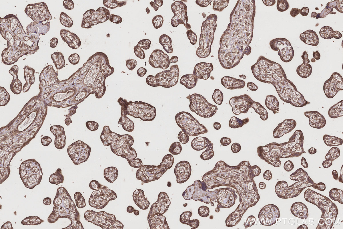 Immunohistochemical analysis of paraffin-embedded human placenta tissue slide using KHC3211 (ABCG1 IHC Kit).