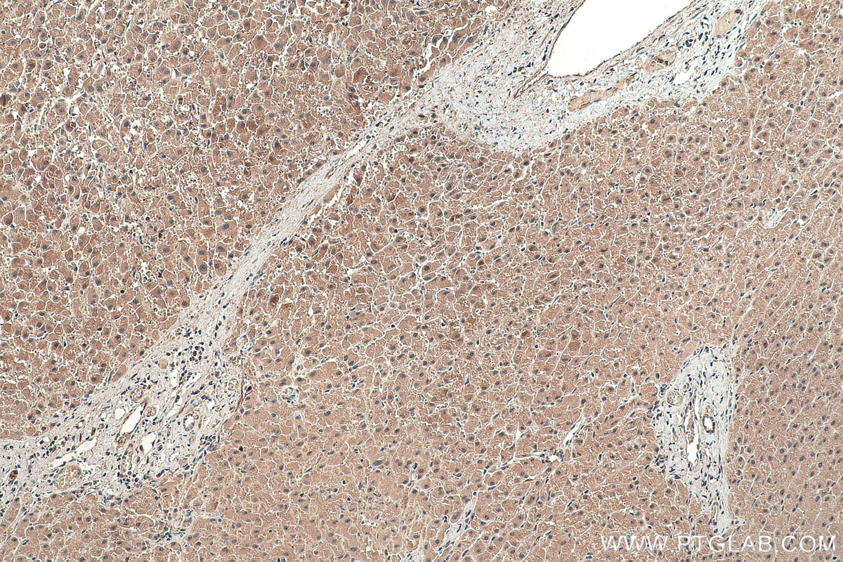 Immunohistochemical analysis of paraffin-embedded human liver tissue slide using KHC0392 (ABHD14B IHC Kit).