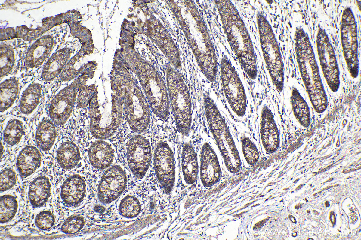 Immunohistochemical analysis of paraffin-embedded human colon tissue slide using KHC1113 (ABHD5 IHC Kit).