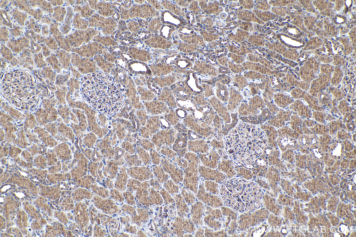 Immunohistochemical analysis of paraffin-embedded human kidney tissue slide using KHC1113 (ABHD5 IHC Kit).