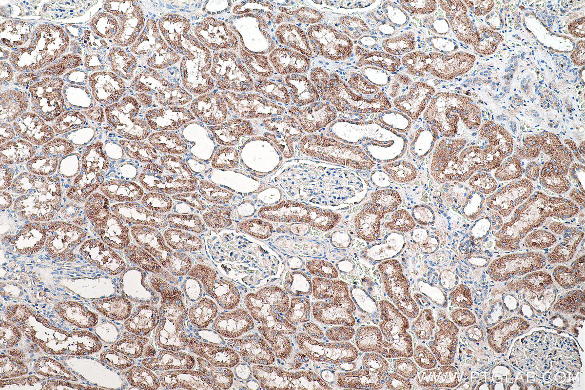 Immunohistochemical analysis of paraffin-embedded human kidney tissue slide using KHC0555 (ACAA1 IHC Kit).