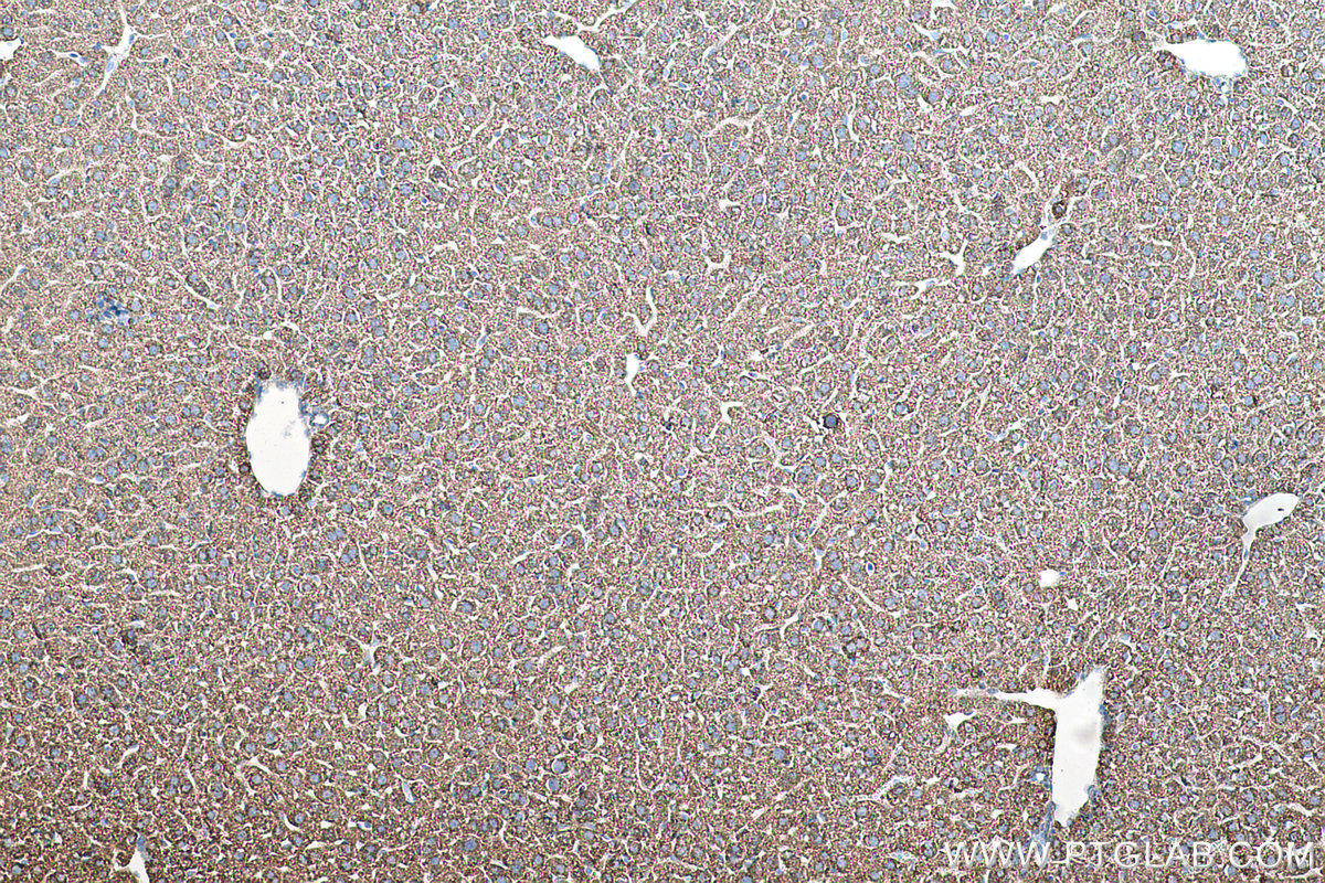 Immunohistochemical analysis of paraffin-embedded mouse liver tissue slide using KHC0502 (ACAA2 IHC Kit).