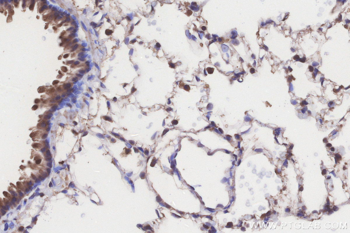 Immunohistochemical analysis of paraffin-embedded rat lung tissue slide using KHC3205 (ACADL IHC Kit).
