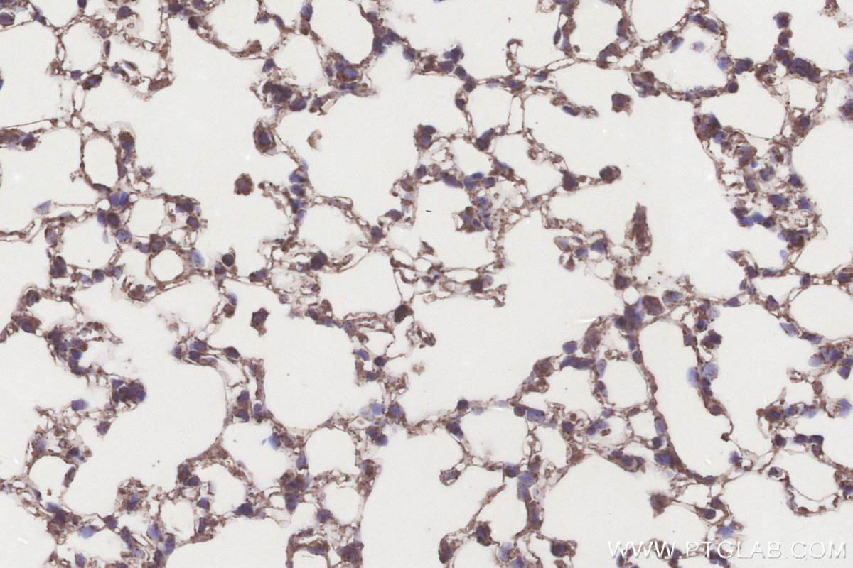 Immunohistochemical analysis of paraffin-embedded mouse lung tissue slide using KHC3205 (ACADL IHC Kit).