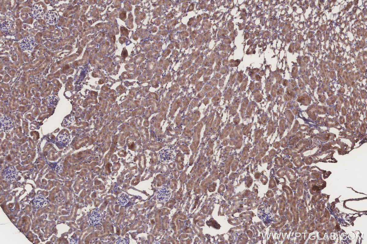 Immunohistochemical analysis of paraffin-embedded mouse kidney tissue slide using KHC3205 (ACADL IHC Kit).