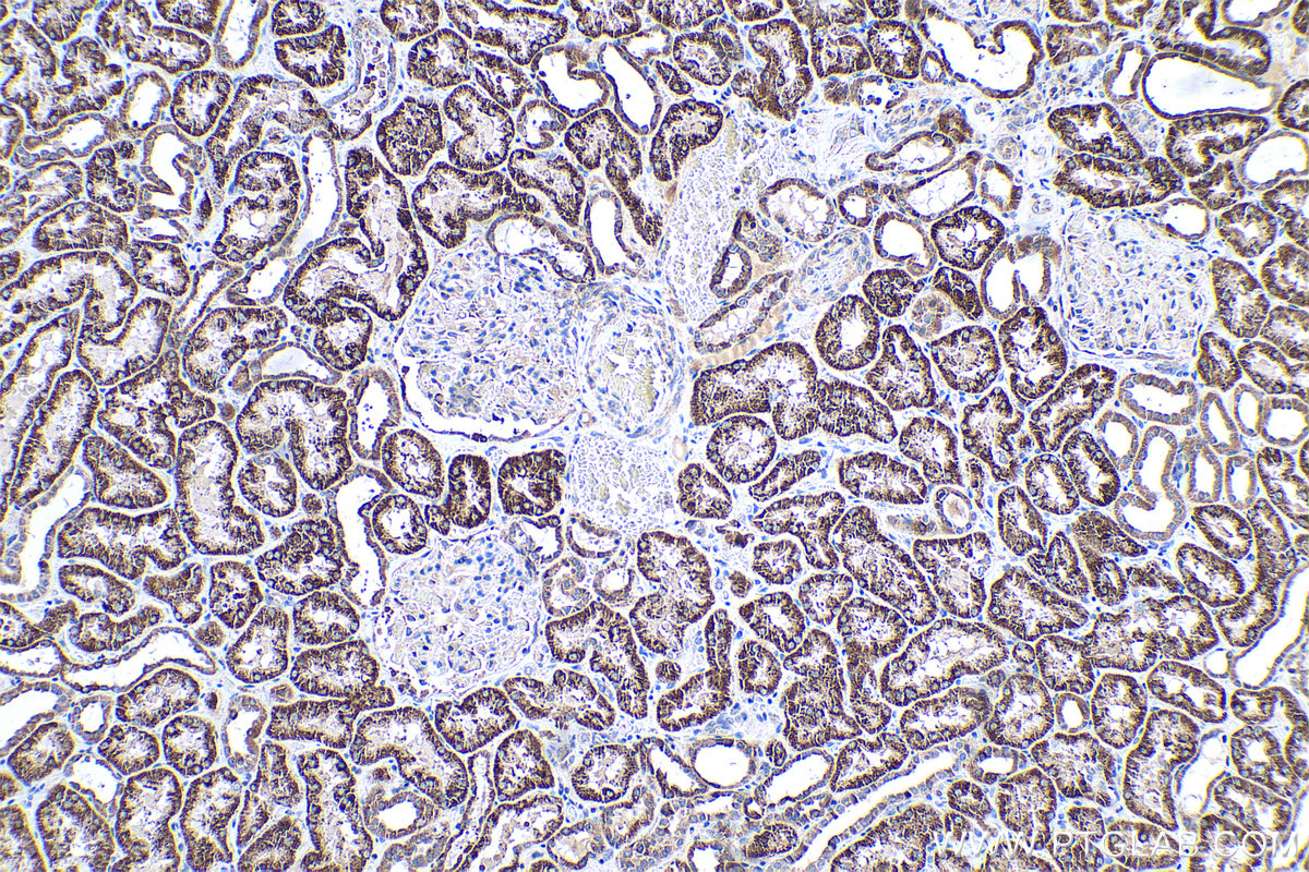 Immunohistochemical analysis of paraffin-embedded human kidney tissue slide using KHC0537 (ACADSB IHC Kit).