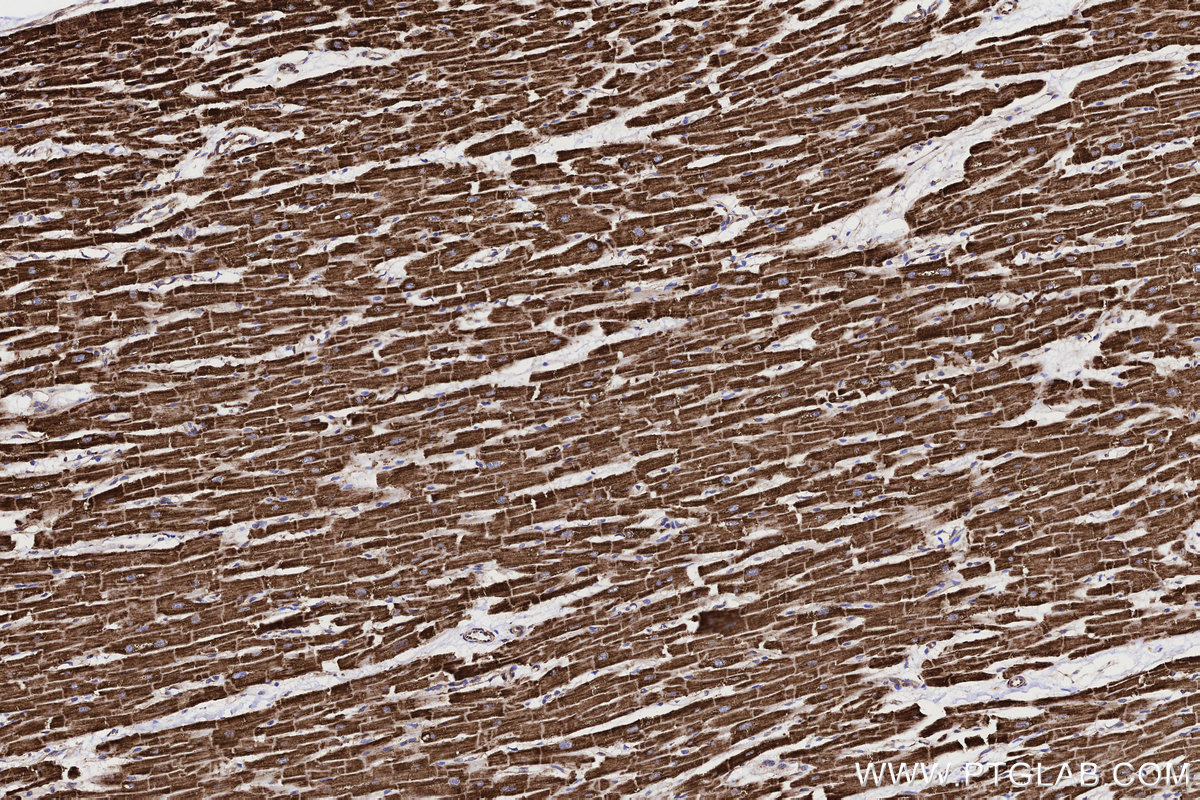 Immunohistochemical analysis of paraffin-embedded human heart tissue slide using KHC3218 (ACADVL IHC Kit).