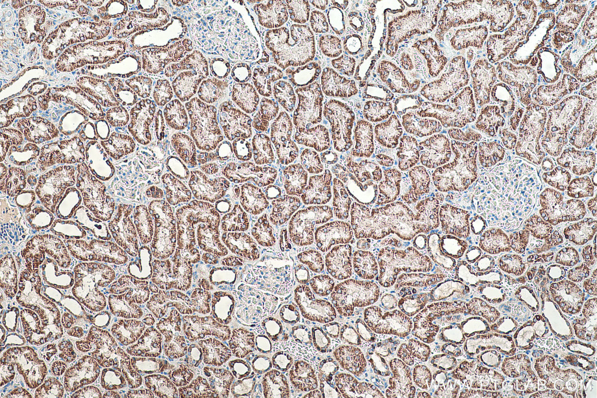 Immunohistochemical analysis of paraffin-embedded human kidney tissue slide using KHC0504 (ACAT1 IHC Kit).