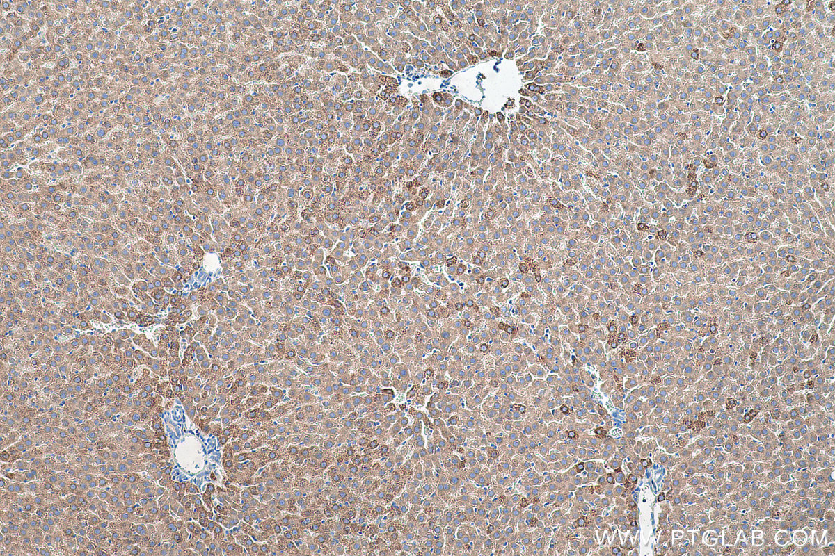 Immunohistochemical analysis of paraffin-embedded rat liver tissue slide using KHC0504 (ACAT1 IHC Kit).