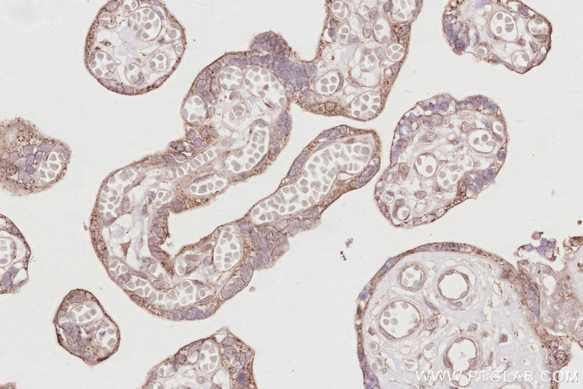 Immunohistochemical analysis of paraffin-embedded human placenta tissue slide using KHC2910 (ACBD3 IHC Kit).