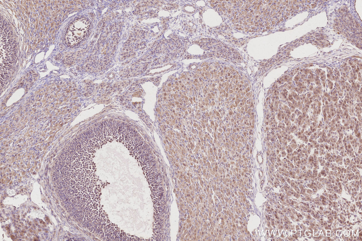 Immunohistochemical analysis of paraffin-embedded rat ovary tissue slide using KHC2910 (ACBD3 IHC Kit).