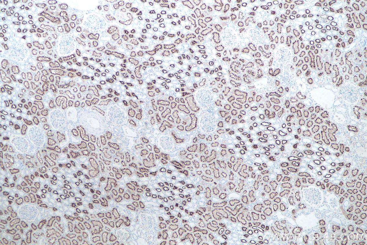 Immunohistochemical analysis of paraffin-embedded human kidney tissue slide using KHC0062 (ACE2 IHC Kit).