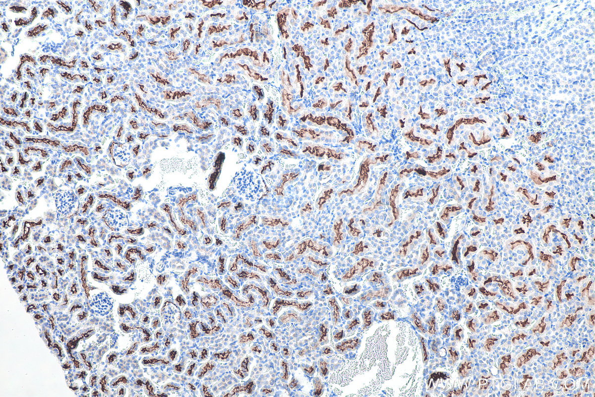 Immunohistochemical analysis of paraffin-embedded mouse kidney tissue slide using KHC0062 (ACE2 IHC Kit).