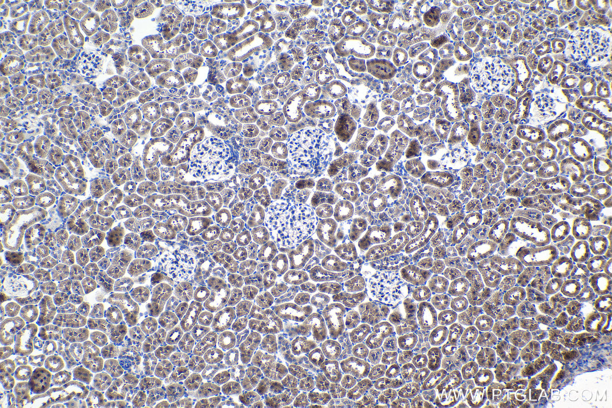 Immunohistochemical analysis of paraffin-embedded rat kidney tissue slide using KHC1038 (ACOT9 IHC Kit).