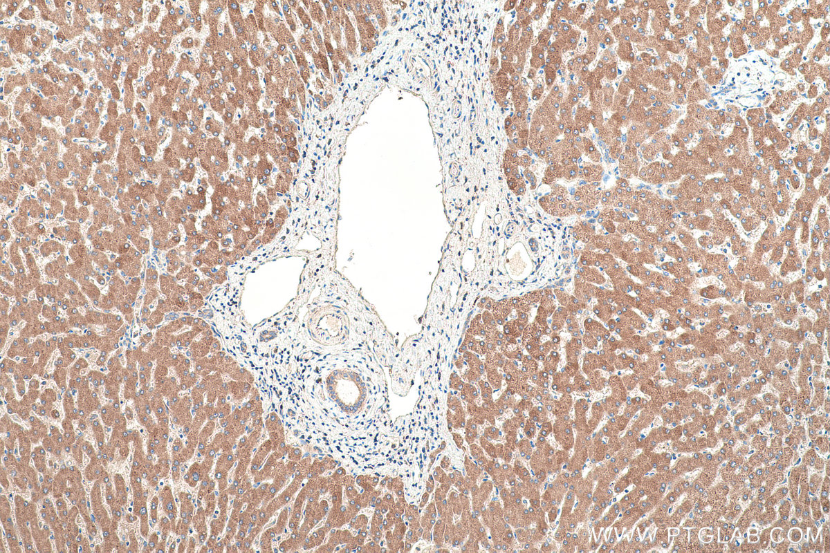 Immunohistochemical analysis of paraffin-embedded human liver tissue slide using KHC0393 (ACSL1 IHC Kit).