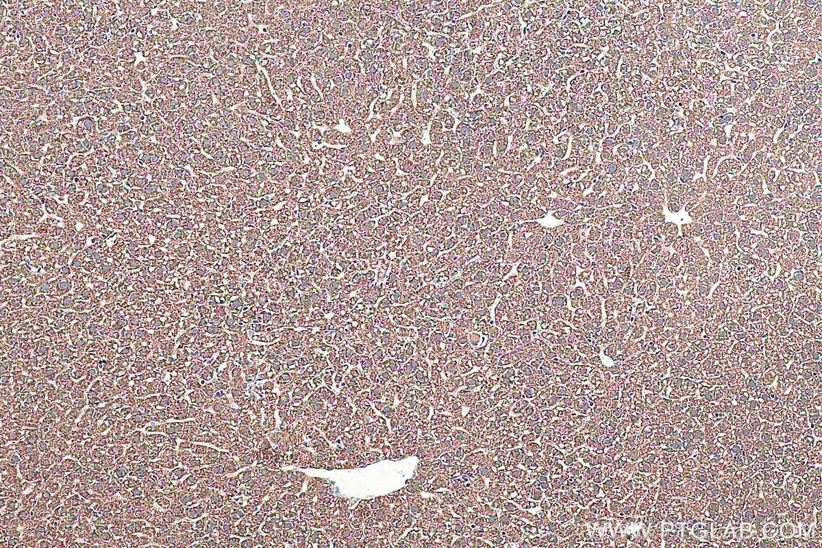 Immunohistochemical analysis of paraffin-embedded mouse liver tissue slide using KHC0393 (ACSL1 IHC Kit).