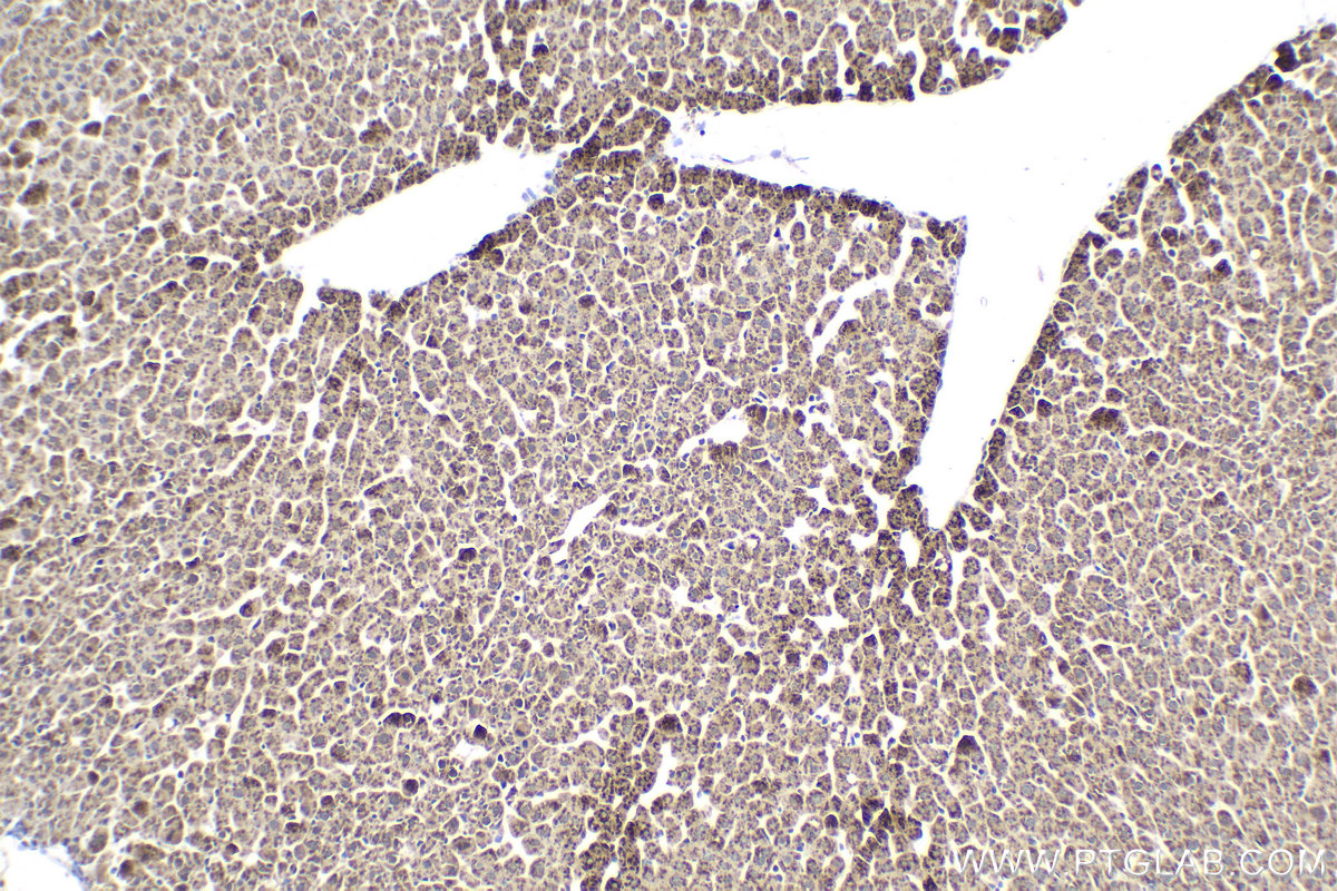 Immunohistochemical analysis of paraffin-embedded rat liver tissue slide using KHC2144 (ACSL3 IHC Kit).