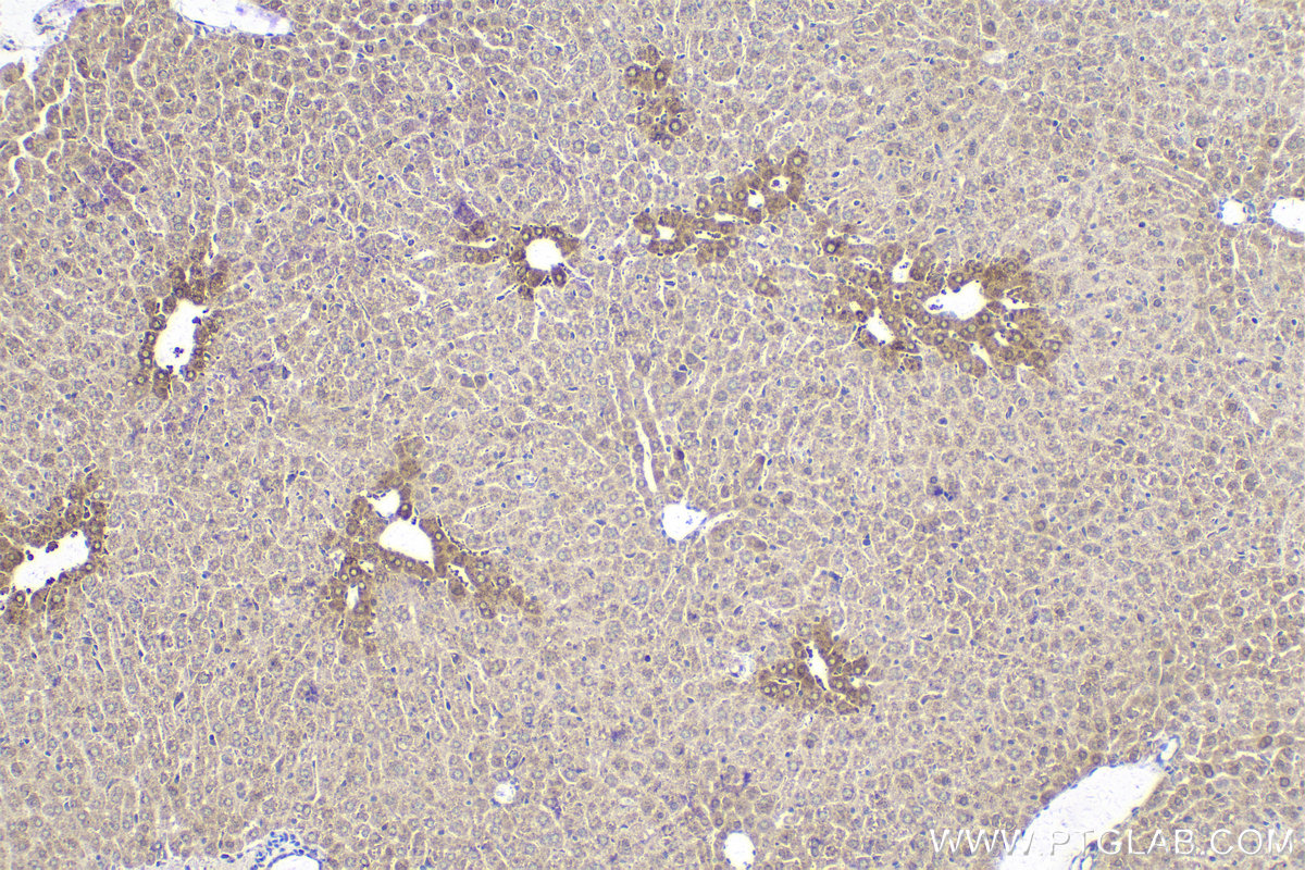 Immunohistochemical analysis of paraffin-embedded mouse liver tissue slide using KHC2144 (ACSL3 IHC Kit).