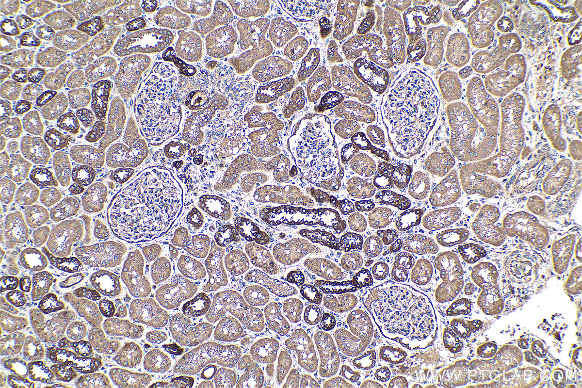 Immunohistochemical analysis of paraffin-embedded human kidney tissue slide using KHC0474 (ACSL4 IHC Kit).