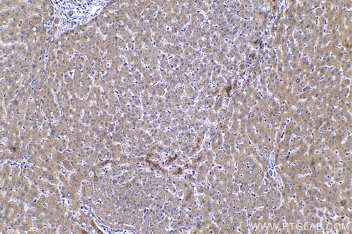 Immunohistochemical analysis of paraffin-embedded human liver tissue slide using KHC0474 (ACSL4 IHC Kit).