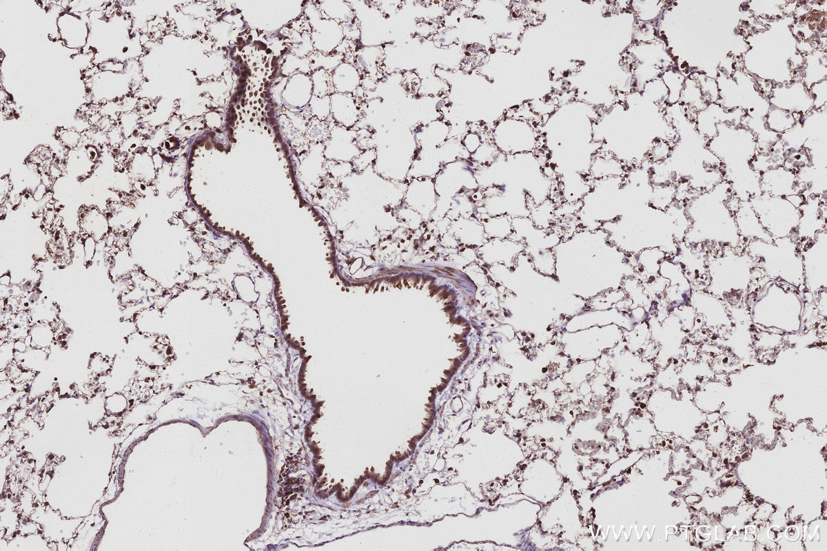 Immunohistochemical analysis of paraffin-embedded rat lung tissue slide using KHC3033 (ACSL5 IHC Kit).