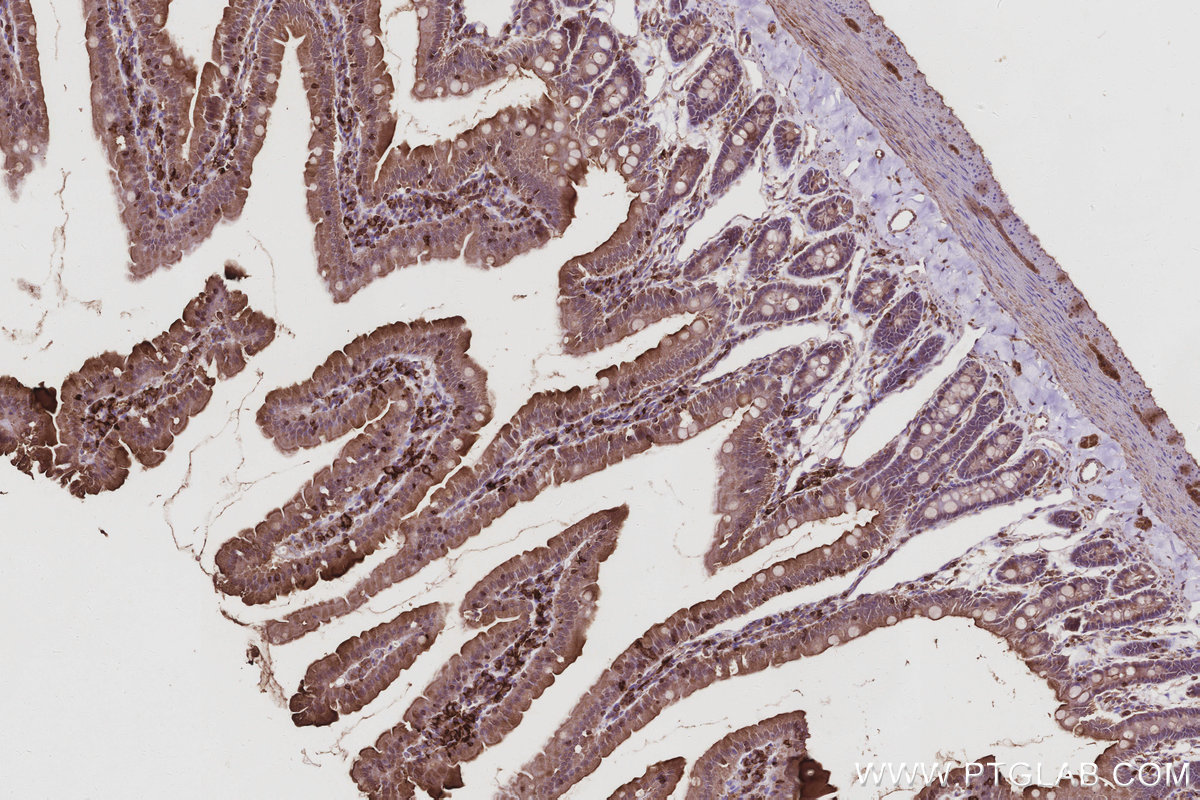 Immunohistochemical analysis of paraffin-embedded rat small intestine tissue slide using KHC3033 (ACSL5 IHC Kit).