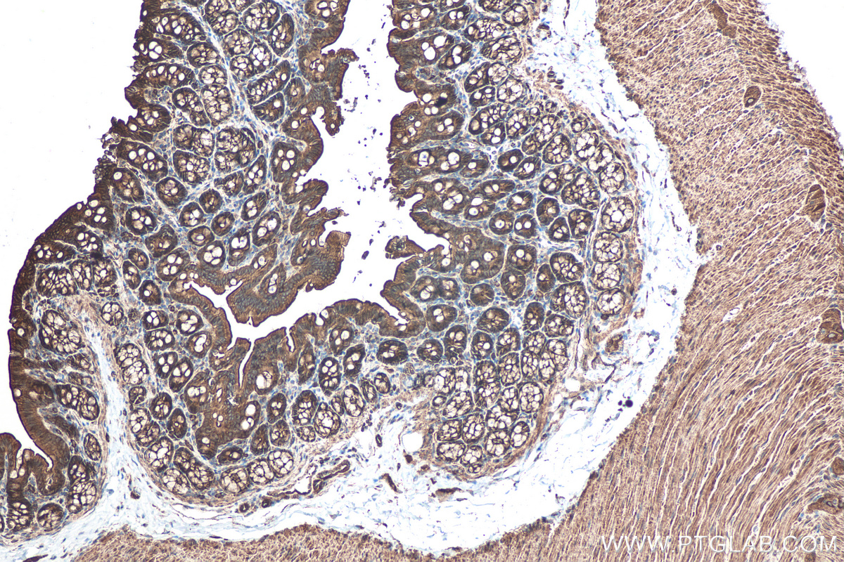 Immunohistochemical analysis of paraffin-embedded rat colon tissue slide using KHC0512 (ACTG1 IHC Kit).