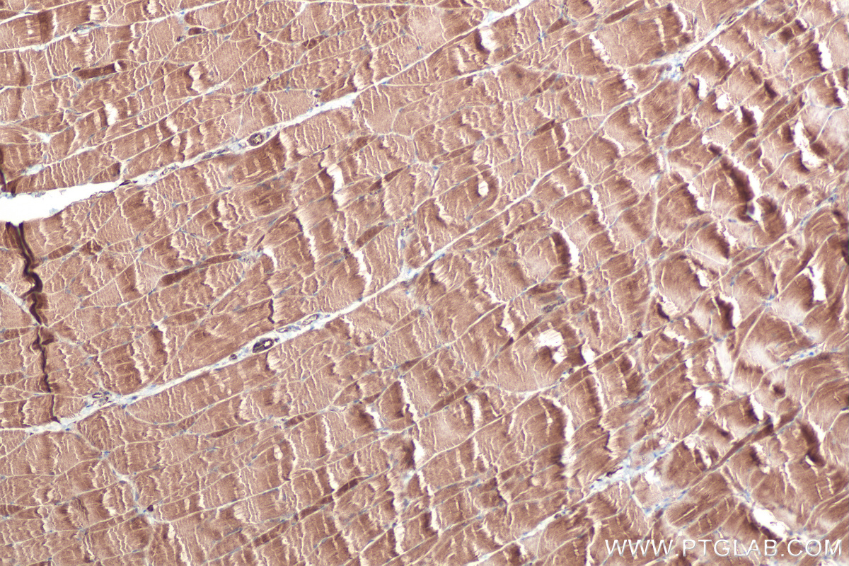 Immunohistochemical analysis of paraffin-embedded rat skeletal muscle tissue slide using KHC0512 (ACTG1 IHC Kit).