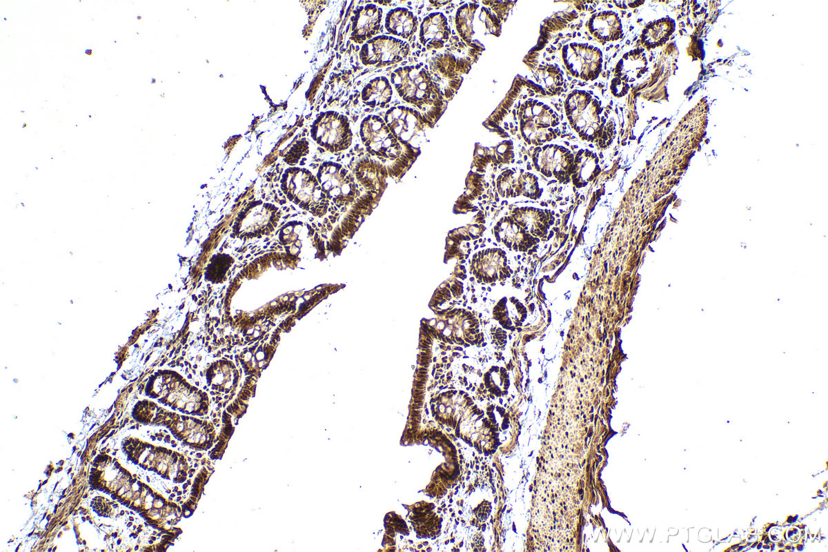 Immunohistochemical analysis of paraffin-embedded rat colon tissue slide using KHC0982 (ACTL6A IHC Kit).
