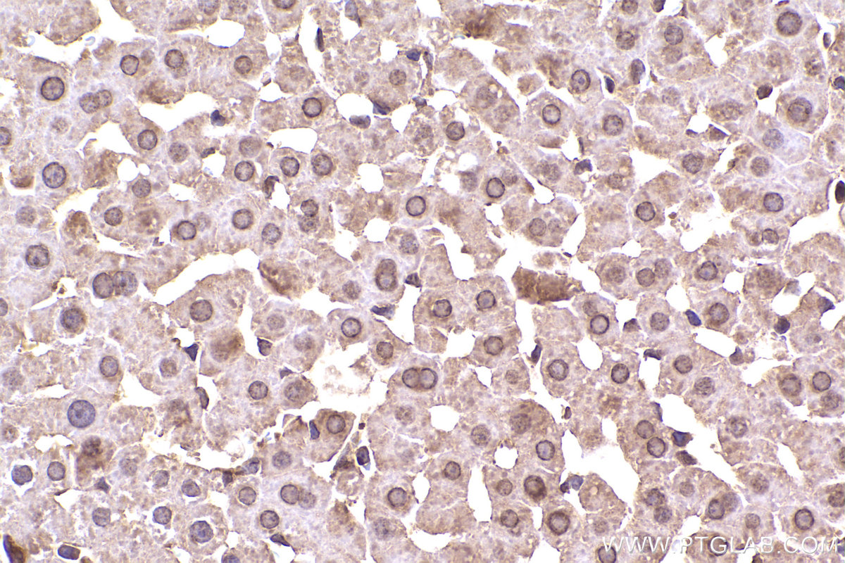 Immunohistochemical analysis of paraffin-embedded rat liver tissue slide using KHC2338 (ACTR1A IHC Kit).