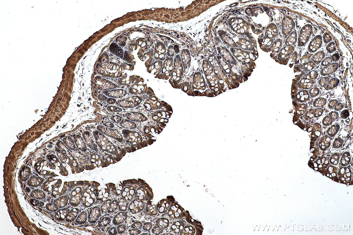 Immunohistochemical analysis of paraffin-embedded mouse colon tissue slide using KHC0728 (ACTR2 IHC Kit).