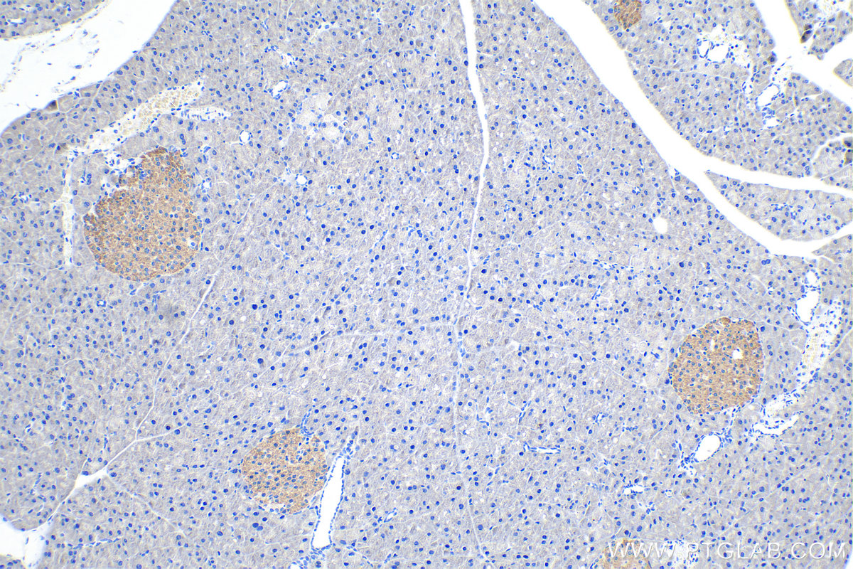 Immunohistochemical analysis of paraffin-embedded mouse pancreas tissue slide using KHC0241 (ACVR1C/ALK7 IHC Kit).