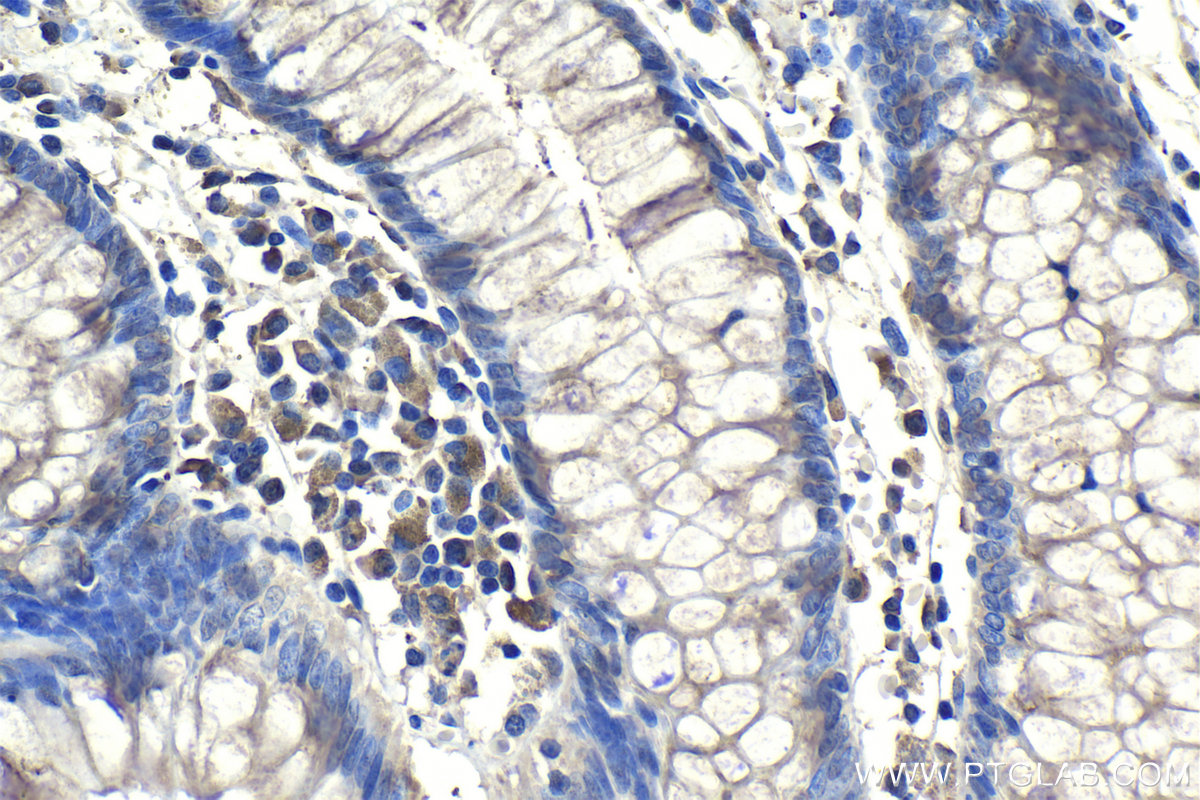 Immunohistochemical analysis of paraffin-embedded human colon tissue slide using KHC1159 (ADAMDEC1 IHC Kit).