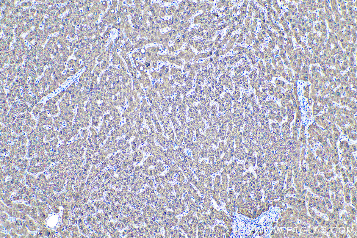 Immunohistochemical analysis of paraffin-embedded human liver tissue slide using KHC0522 (ADH1C IHC Kit).